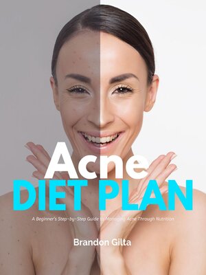 cover image of Acne Diet Plan
